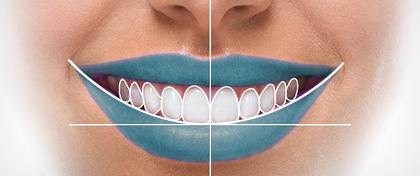 estética dental en Gijón
